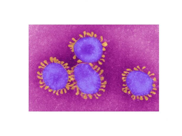 Requisições administrativas de bens móveis motivadas pela pandemia de Coronavírus, como proceder?